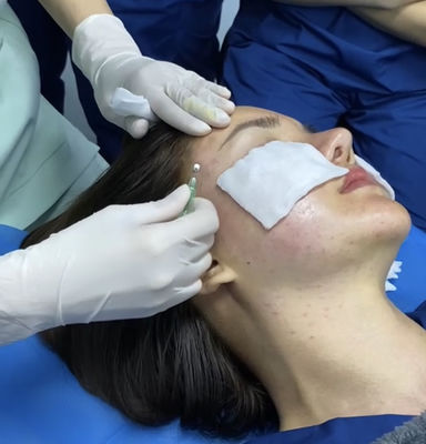 Глубокая линия потоки регенерации колючие PDO коллагена удаления