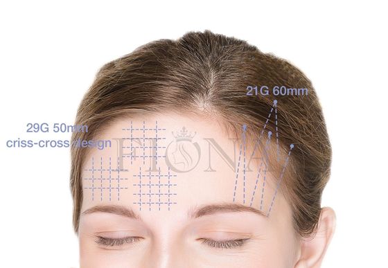Cog PLACL PCL PDO продевает нитку/колючие потоки для Foxy Ponytail глаза поднимая 360 4D 6D 12D