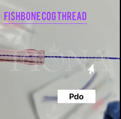 Поток Cog прессформы Fishbone
