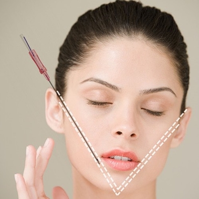Nonsurgical поток 18G 100mm Cog подниматься стороны потока PDO для немедленный подниматься стороны